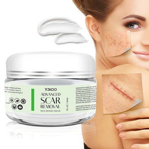Generic Scar Removal Cream - Advanced Treatment for Face & Body, Old & New Scars