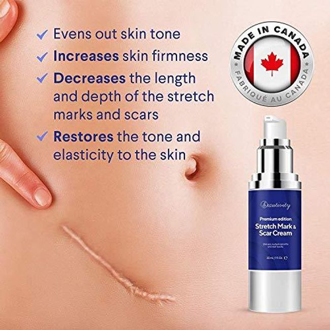 Premium Edition Scar Removal Cream for Scars from C-Section, Stretch Marks, Acne, Surgery, Injury, Burns, Made in Canada